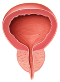 Enlarged Prostate